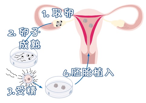 生殖中心环境